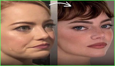 Emma Stone Face Lift: Unveiling the Truth Behind Her Stunning Transformation